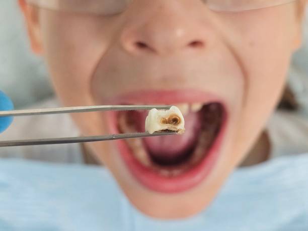 Best Emergency Dental Extractions in Sparrow Bush, NY