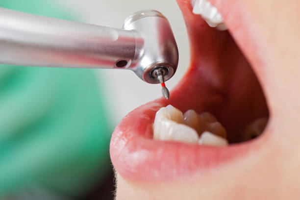Best Pediatric Emergency Dentist in Sparrow Bush, NY